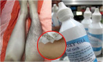 Nghịch dại thoa oxy già lên chân và tay, không ngờ các sợi lông rụng sạch không còn 1 cọng khiến ai cũng ngỡ ngàng