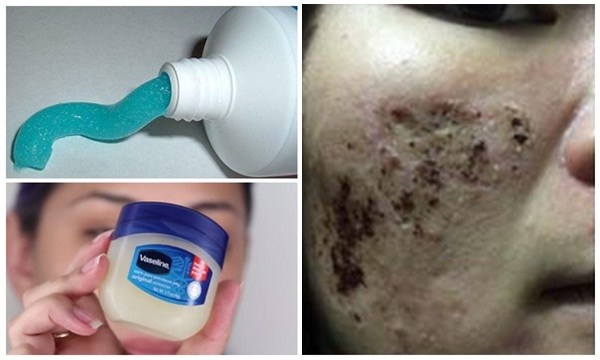 HOT 1000 độ C: Bôi trực tiếp 5 thứ này lên da chẳng khác nào tự biến tiên dược thành độc dược