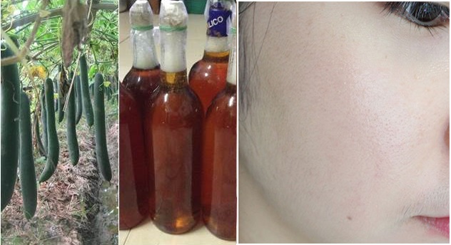 Giảm 5k/1 ngày, sau 3 ngày da không còn 1 nốt mụn thâm nám mà còn trắng bật lên tông