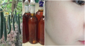 Giảm 5k/1 ngày, sau 3 ngày da không còn 1 nốt mụn thâm nám mà còn trắng bật lên tông