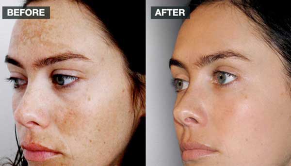 Nếu quá lười đắp mặt nạ hay thoa kem, hãy bôi cái này vào để da đẹp, mềm, mịn hơn da em bé