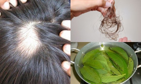 Luộc ngay nắm lá ổi làm nước gội đầu, mái tóc dễ rụng, chẻ ngọn hay xơ rối cỡ nào cũng trở nên dày dặn, óng mượt ngay tức thì