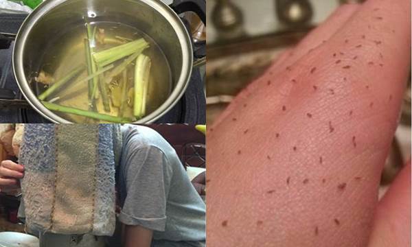 Chuẩn bị SẢ + CHANH + GỪNG rồi đun bộ 3 này lấy nước xông hơi 1 tuần 2 lần, mụn tự khắc chui ra, da trắng hồng chẳng cần thoa 1 giọt kem nào