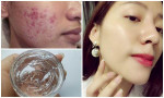 Mỗi tối thoa 3 giọt này lên mặt, da ngăm đen, thâm mụn cũng trắng lên hồng hào lại trẻ ra cả chục tuổi