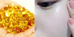 Muốn da trắng không khó, chỉ cần mua vitamin E rồi làm theo 2 cách dưới đây