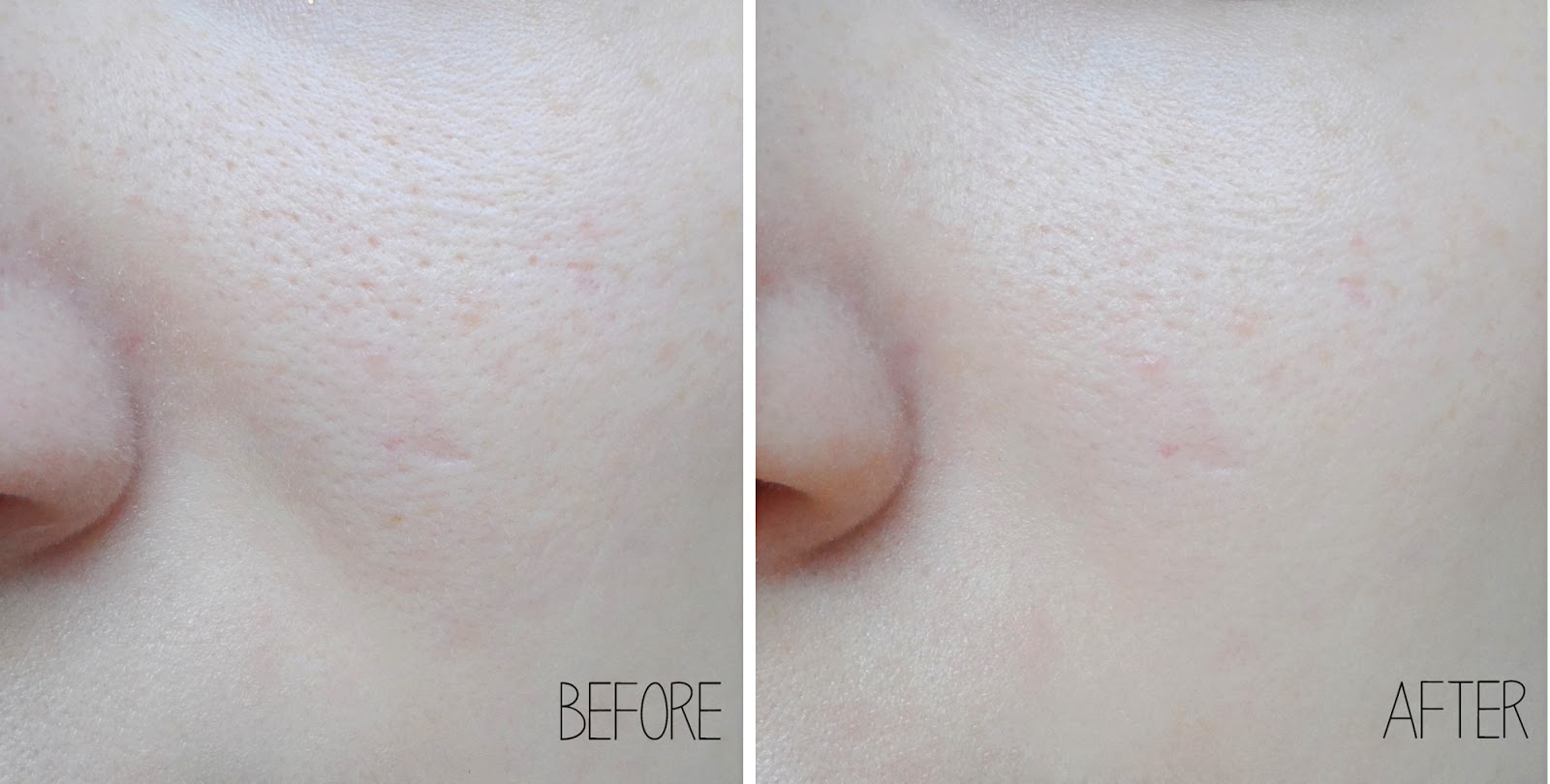 Lỗ chân lông mãi không to trở lại khi đã thuộc lòng 6 mẹo này