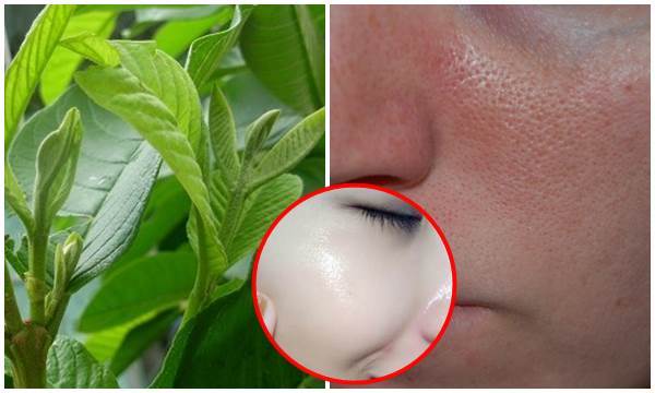 Lấy lá ổi non xay nhuyễn đắp mặt, lỗ chân lông to như sẹo rỗ cũng được se khít 99% lại sạch cả mụn trứng cá