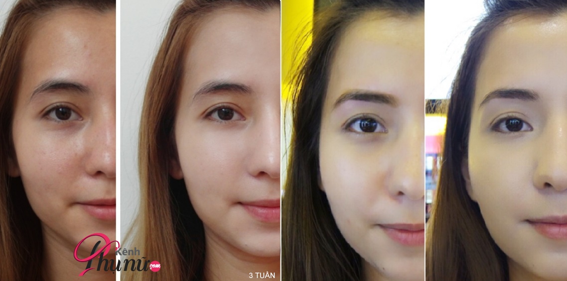 Hot: Hội chị em truyền tai nhau cách sử dụng viên trái tim màu vàng co da căng sáng thần kỳ chỉ sau 1 đêm