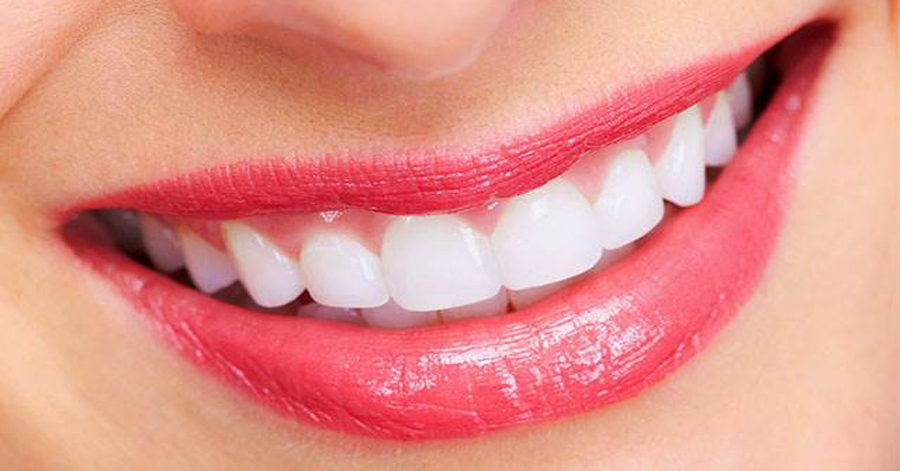 Răng trắng sáng gấp 3 lần, mảng bám cứng như vôi cũng bật ra bằng sạch