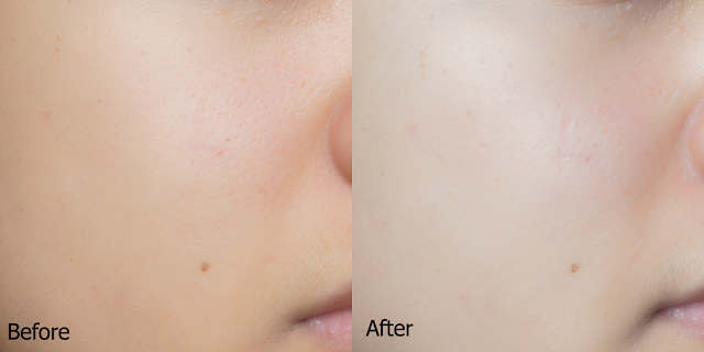 Chị nào lỗ chân lông to da lại đen thì vào đây em chỉ cho cách tự nhiên này, bôi lên da đơn giản mà hiệu quả lắm đấy