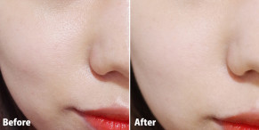 Mẹo thu nhỏ lỗ chân lông to chưa đến 10k ai cũng phải biết