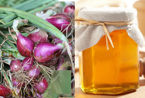 Sẹo thâm tím như hoa sim cũng khỏi nhờ công thức dễ ợt từ hành tím