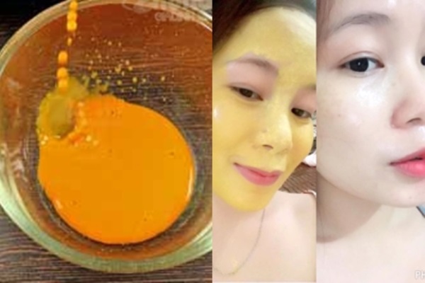 Vừa trị mụn, vừa dưỡng trắng da siêu nhanh chỉ với 1 muỗng bột nghệ