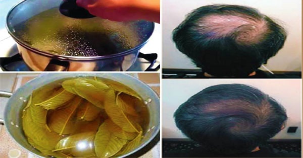 Trị tóc rụng như mưa chỉ với 1 nắm lá ổi đun lấy nước