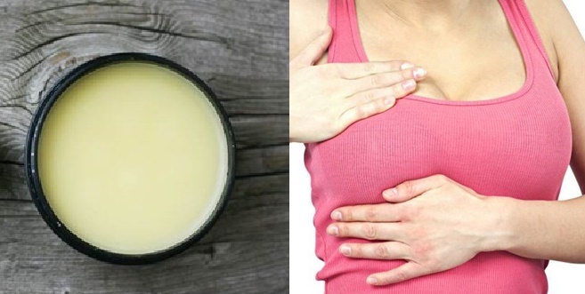 Cứ tưởng Vaseline vô hại nhưng thoa theo cách này thì đừng hỏi tại sao trắng đẹp chưa thấy đâu đã mụn nhọt, lở loét khắp mặt