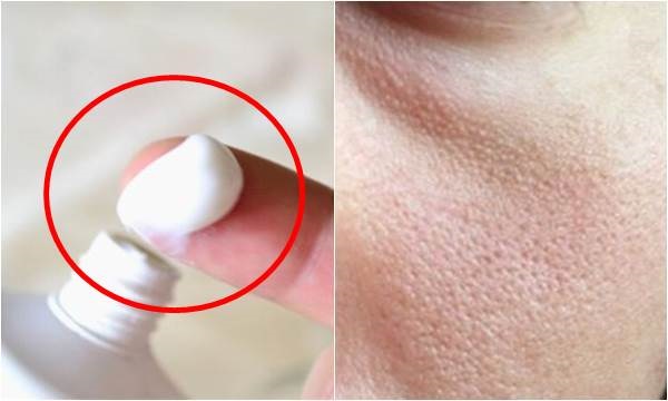 Se khít lỗ chân lông bằng kem đánh răng liệu có hiệu quả như tin đồn?