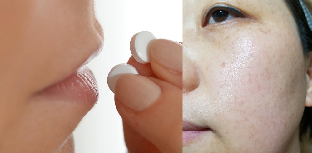 Đây mới là cách trị nám chân sâu, tàn nhang lâu năm hiệu quả từ gốc, an toàn không lo tái phát
