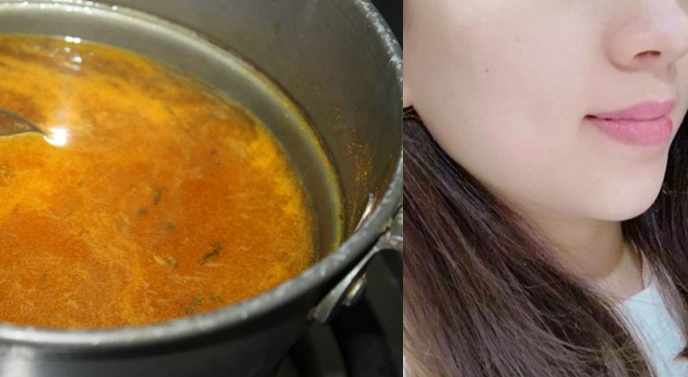 Xông hơi theo cách này mỗi tuần, mụn hay vết thâm mụn có dai dẳng đến mấy cũng hết sạch sau 7 ngày