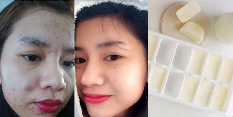 Nhét cả bịch sữa tươi vào ngăn đá rồi lấy ra chà đến đâu da trắng đến đấy, càng sờ càng thích