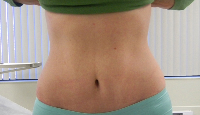 Tuyêt chiêu giảm 14cm vòng bụng không cần ăn kiêng