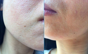 Dị ứng mỹ phẩm - Nỗi lo hàng đầu của chị em khi dùng mỹ phẩm