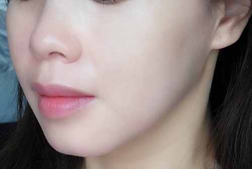 Ai bị mụn thịt, mụn cám lâu năm, vò nát nắm lá tía tô đem trộn thứ này thoa 2 lần, nhân mụn tự động trồi lên da lại sáng hồng mướt mịn