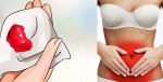 Nếu kinh nguyệt có dấu hiệu này bạn hãy đi khám ngay kẻo hối hận không kịp