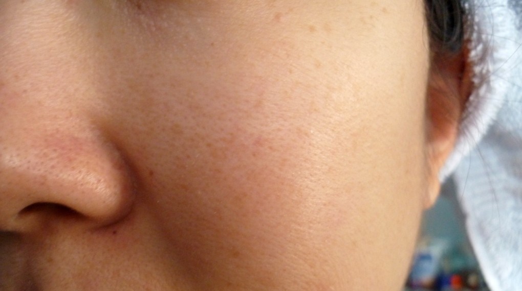 CÁCH ĐỂ TỰ LÀM SE LỖ CHÂN LÔNG MÀ KHÔNG CẦN ĐI SPA