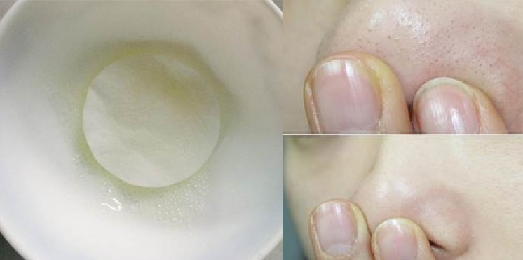 Nhúng bông tẩy trang vào nước cốt chanh rồi đắp lên da, cái kết khiến bạn nào cũng muốn làm ngay lập tức, không lo bắt nắng