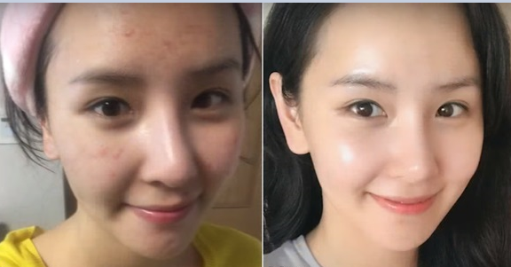 Con gái Hàn da sạch mụn, bóng mịn, căng mướt là nhờ có công thức pha toner với nước để rửa mặt