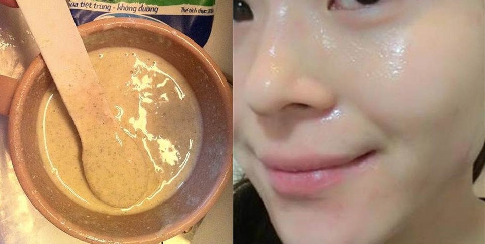 Đi biển về bị cháy nắng, tắm ngay với hỗn hợp này để da trắng bật 3 tông sau 1 tuần không thứ gì sánh bằng