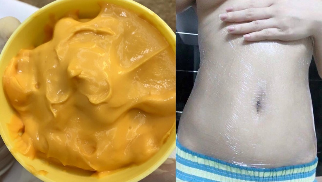 Hỗn hợp tự làm từ gừng – sả – ớt, làm 1 lần, dùng 1 tuần, bao nhiêu mỡ bụng cứ tự động tan chảy hết, eo phẳng lỳ chỉ sau 1 tháng