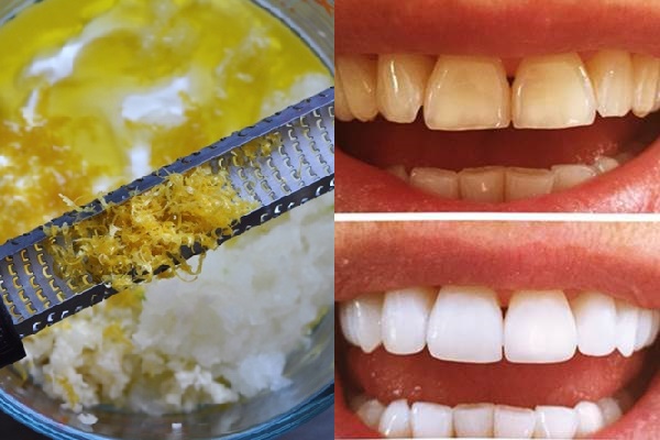 Răng ố vàng cỡ nào, chỉ cần trộn thứ này với muối rồi chà là trắng bóng không tì vết