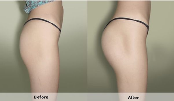 Tuyệt chiêu giúp bạn gái tăng vòng 3 nhanh "chóng mặt"