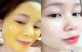 Da xấu đến đâu cũng phải trắng mịn với những công thức mặt nạ tinh nghệ sau