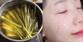 Xông mặt bằng sả rồi chà đá sữa tươi lên, da trắng toát, mụn hết sạch không gì sánh bằng