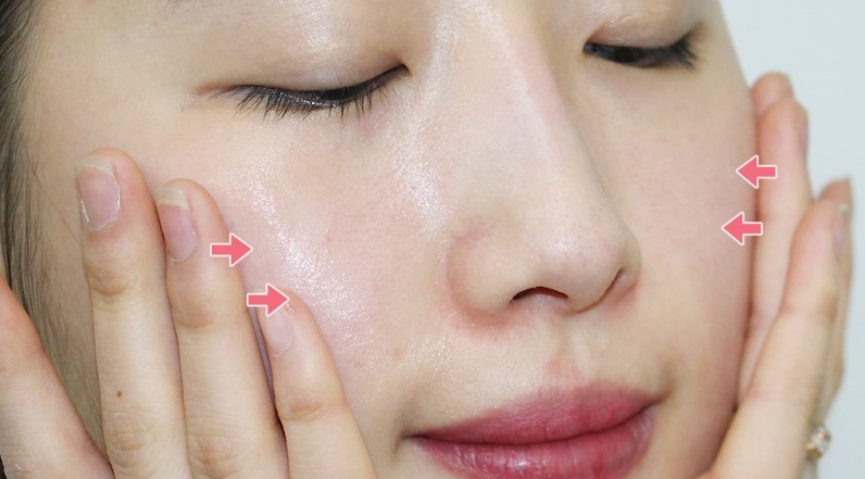 Tư vấn trị nám từ gốc và cách giúp nám không bị tái phát sau quá trình điều trị