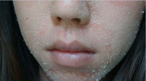 Nếu da bị khô vì bật điều hòa đi ngủ thì đọc ngay bài viết này, nó sẽ cứu sống bạn đấy