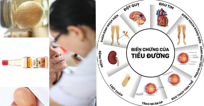 Bài thuốc đơn giản nhưng tốt nhất giúp phòng chống các loại biến chứng tiểu đường