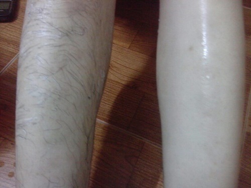 CỰC HOT: Mách bạn công thức tẩy sạch lông dọn đẹp "rừng rậm" trên cơ thể nhờ 2 thìa sữa tươi