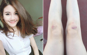 Cứ xuống bếp lấy ngay những loại này để làm toner, da trắng ngay lập tức