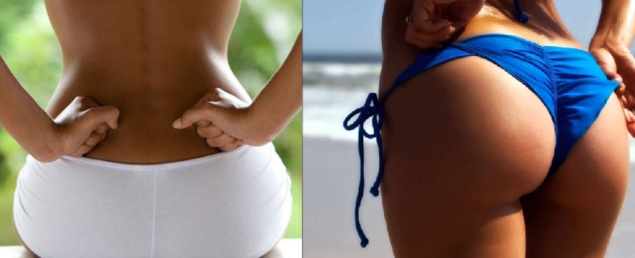 Chồng chê mông thâm sì và em đã lĩnh hội được cách này để chữa mà không cần đến bác sĩ da liễu nhờ 6 bước sau