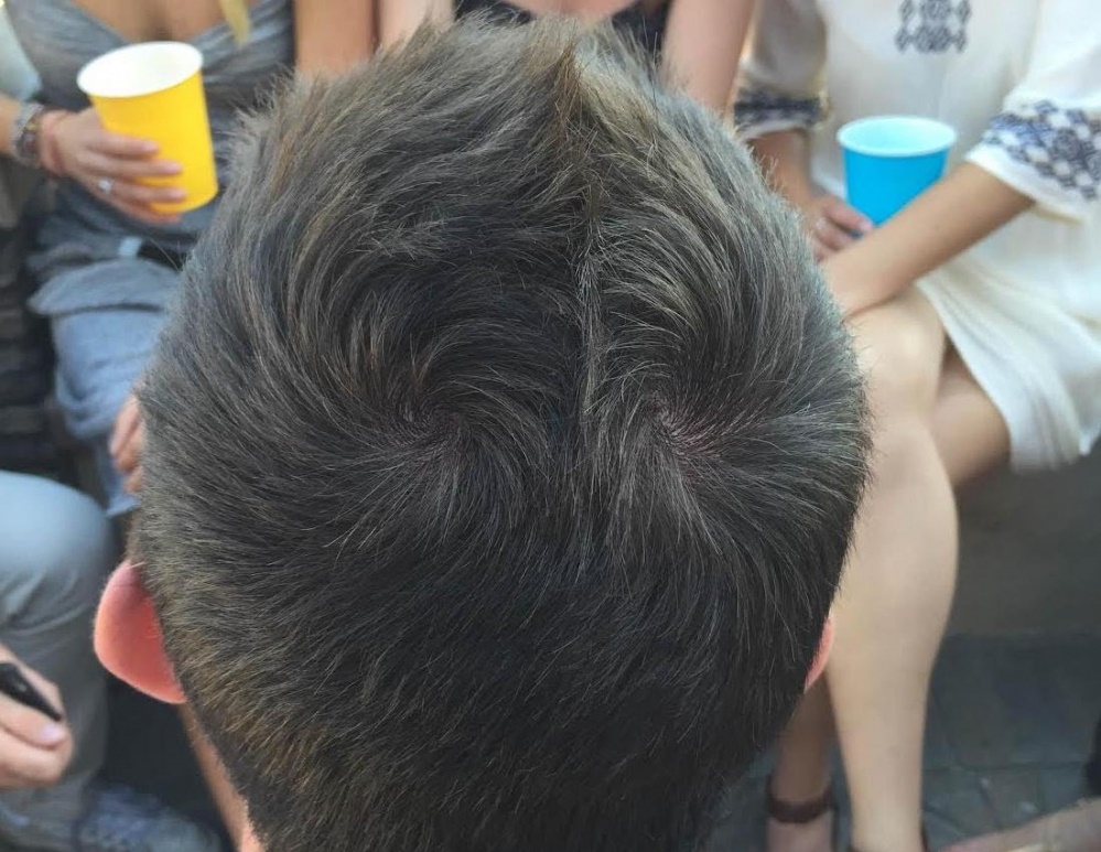 Vạch tóc xem xoáy, biết ngay được tính cách, số phận CHÌM NỔI