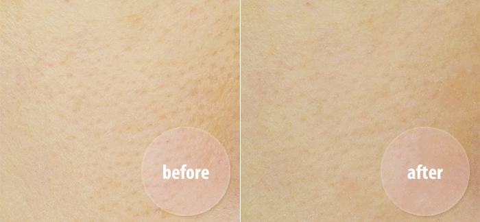 Những bộ đôi nguyên liệu "thần thánh" giúp lỗ chân lông to đến mấy cũng se "khít khìn khịt"