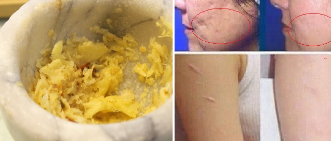 Đắp ít gừng tươi lên mặt - Bao nhiêu công dụng giúp da đẹp vi diệu thế này thì ai cũng nên thử