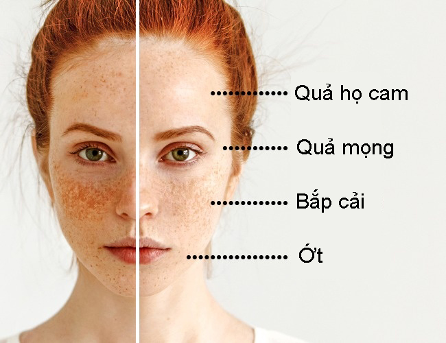 Bác sĩ da liễu ‘chỉ điểm’ các loại thực phẩm trị mọi vấn đề da