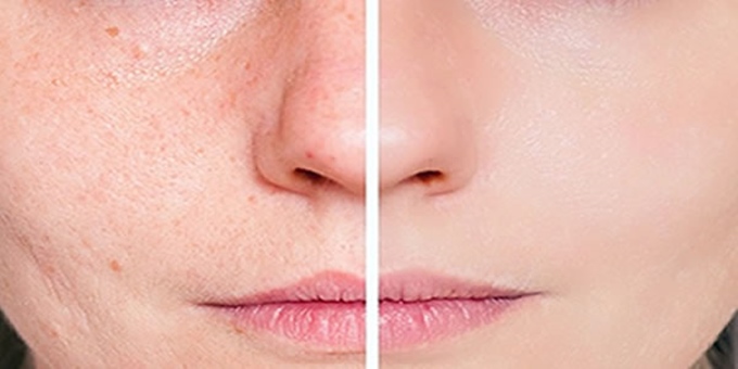 Hãy uống ngay 1 ly nước ấm vào mỗi sáng sớm để nhận lại hàng tá lợi ích