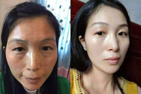 Tận hưởng làn da sạch nám, trắng sáng như thuở đôi mươi cùng thảo dược quý hiếm