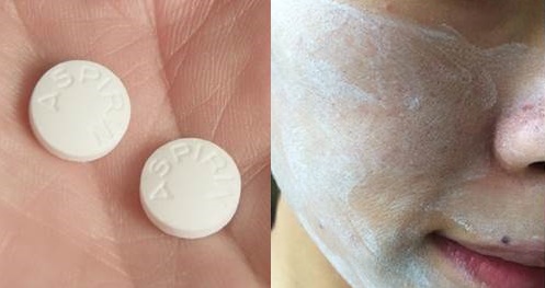 Sạch bong không còn 1 nốt mụn hay vết thâm, ai cũng tưởng tôi đi Spa nhưng thật ra tôi chỉ dùng 1 viên này thôi