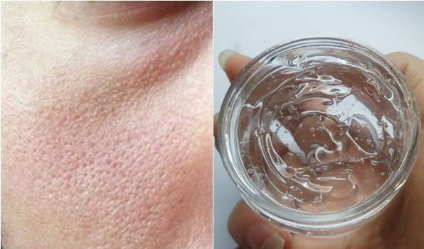 Lỗ chân lông to đến đâu cũng se khít trong 3 ngày với phương pháp này